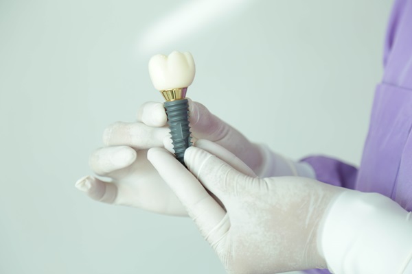 How To Extend The Life Of Your Implant Crown